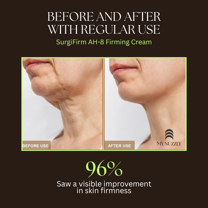 LumiLift Pro (Lift & Define)